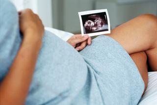 Wszystko, co należy wiedzieć o USG ciąży [WYWIAD]