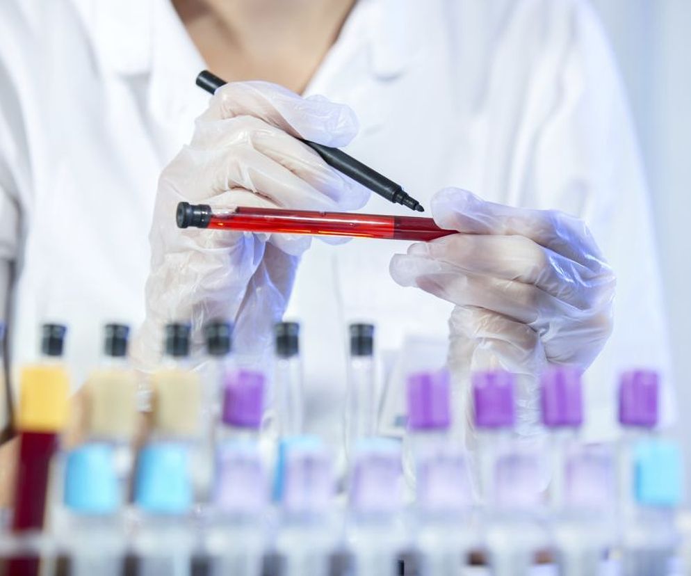 Białko całkowite to wszystkie białka, które są we krwi. Sprawdź, jakie są normy dla białka całkowitego w badaniu biochemicznym i o czym świadczy jego zbyt niski lub zbyt wysoki poziom.