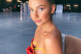 Julia Wieniawa ma rozstępy na piersiach?! Co naprawę widać na jej zdjęciu?