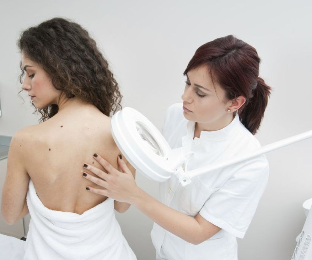 Ziarniniak obrączkowaty  to przewlekła choroba skóry.