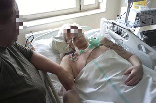 Zmarł, bo lekarz zaszył mu dwie chusty w brzuchu