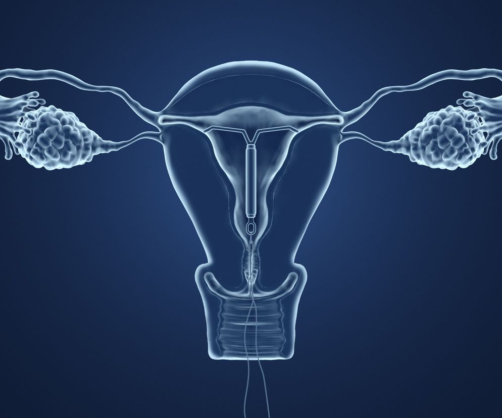 Implant uwalnia niskie dawki progestagenu, który poprzez otaczające go tkanki dostaje się bezpośrednio do krwi.