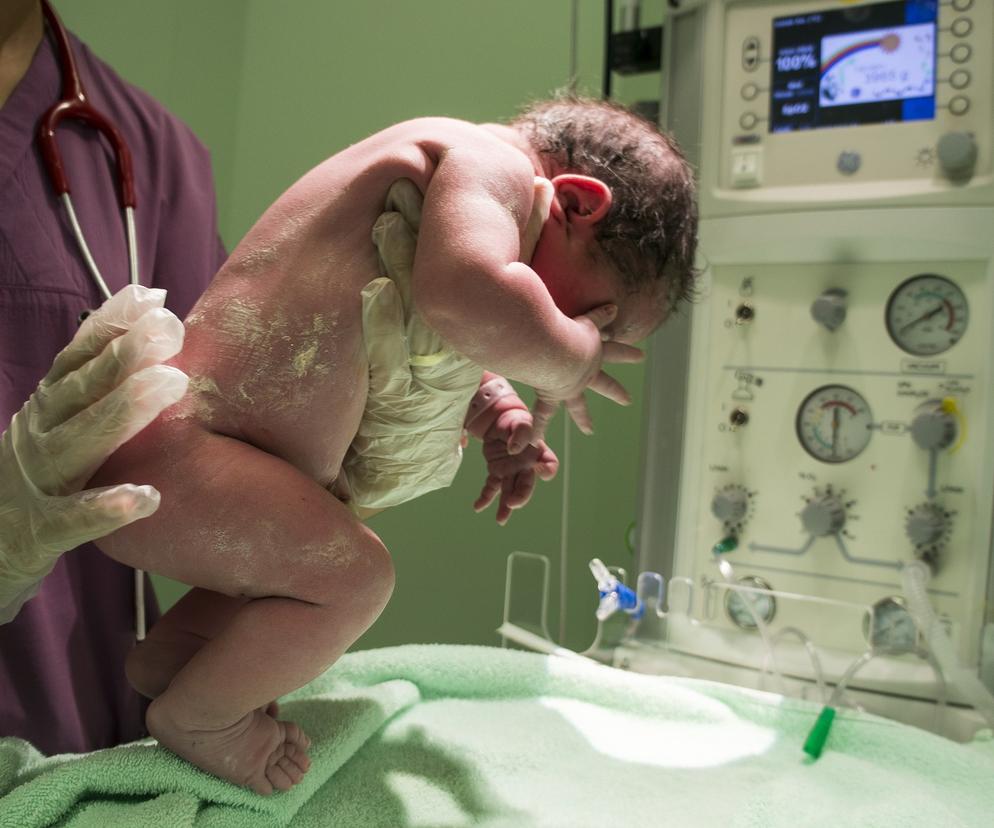 Noworodek spadł ze stolika tuż po porodzie! Wstrząsające szczegóły. W jakim stanie jest dziecko? 