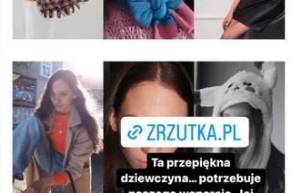 Koszmarny wypadek pięknej modelki. Jej twarz i ręce niemal spłonęły. Wieniawa apeluje o pomoc