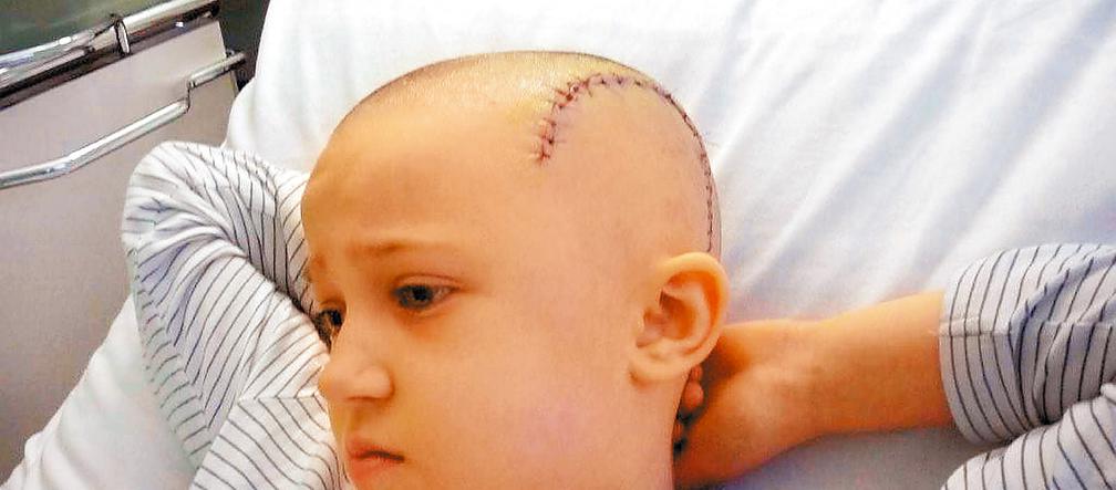 Huśtawka rozłupała mi głowę