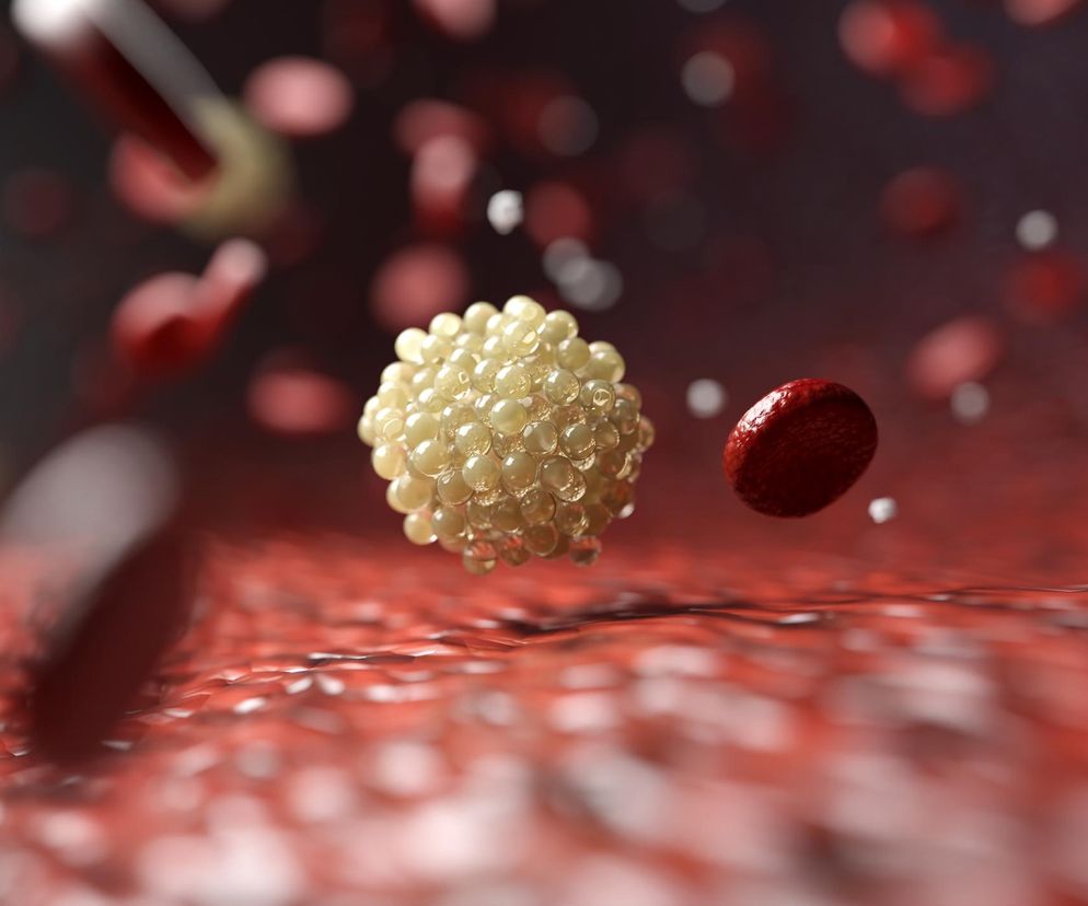 Zaczniemy kontrolować, będzie lżej sercu. Lipoproteina równie ważna jak cholesterol