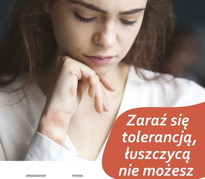 Zaraź się tolerancją, łuszczycą nie możesz - Światowy Dzień Chorych na Łuszczycę (2)