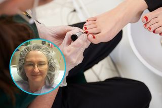 Przez pedicure straciła palec. Kobiety, bądźcie świadome