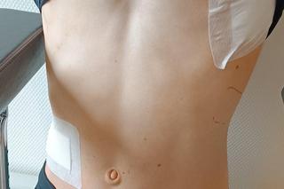 Wielki sukces zbiórki dla Artioma. Pieniądze wciąż spływają na konto. 17-latek został skatowany na Zakrzówku