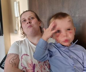 Pies pogryzł 3-latka na przystanku