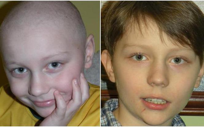 12-letni Damian walczy z guzem mózgu