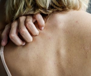 Ta choroba długo daje tylko jeden objaw. Najgorzej jest wieczorem