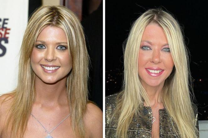 Tara Reid - KIEDYŚ i DZIŚ