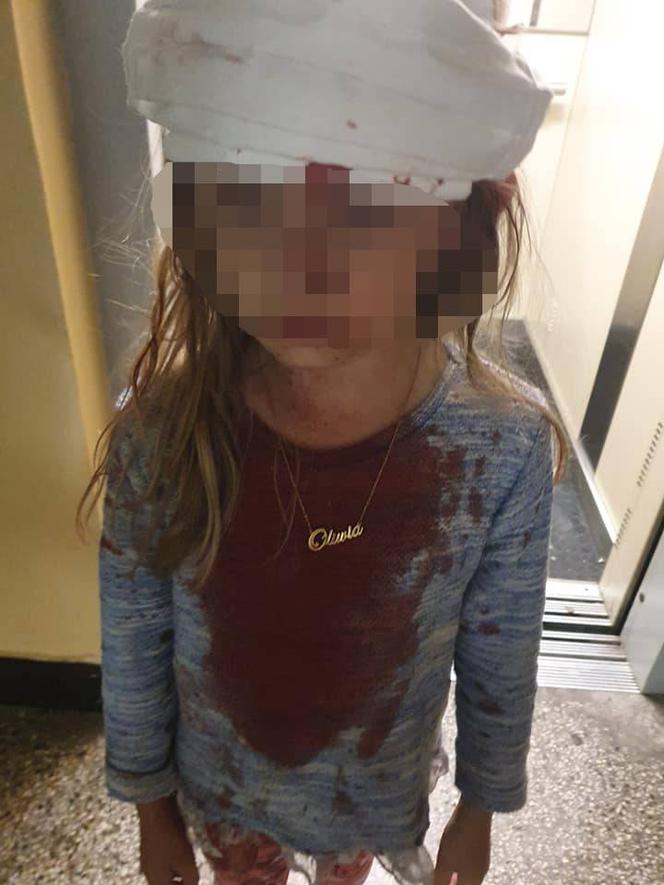 Zakrwawiona dziewczynka przeszła operację w szpitalu w Katowicach