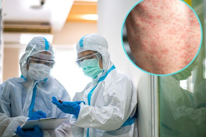 WHO ostrzega przed kolejną epidemią. „Może przerodzić się w tysiące zgonów”