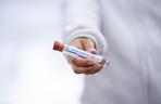 Czym różni się koronawirus od grypy? Odpowiada profesor Simon