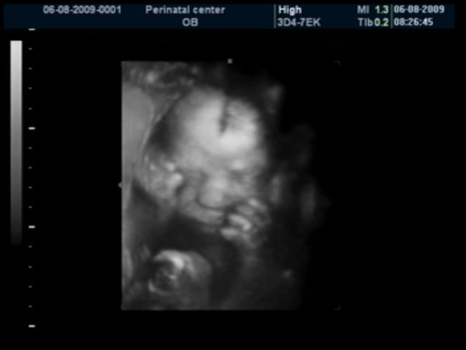 27 tydzień ciąży - USG dziecka
