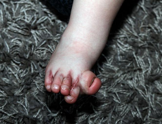 Moja syrenka odzyskała paluszki