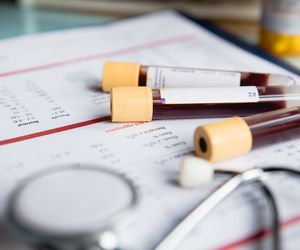 Badania z krwi na pasożyty (parazytologiczne) - na czym polegają?