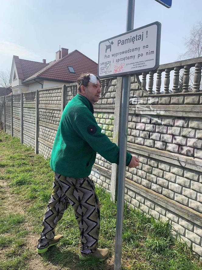 Sławek mógł zginąć przez psią kupę. Gmina tłumaczy się z kuriozalnego znaku