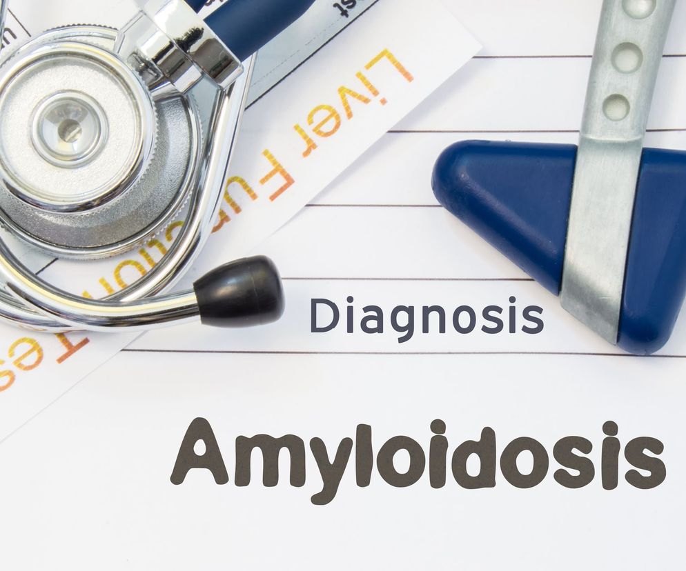 Amyloidoza (skrobiawica, betafibryloza) jest schorzeniem, w którym w organizmie gromadzone są zewnątrzkomórkowe depozyty różnych białek.