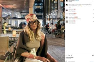 Maja Kuczyńska przeżyła piekło. Całe ciało w oparzeniach