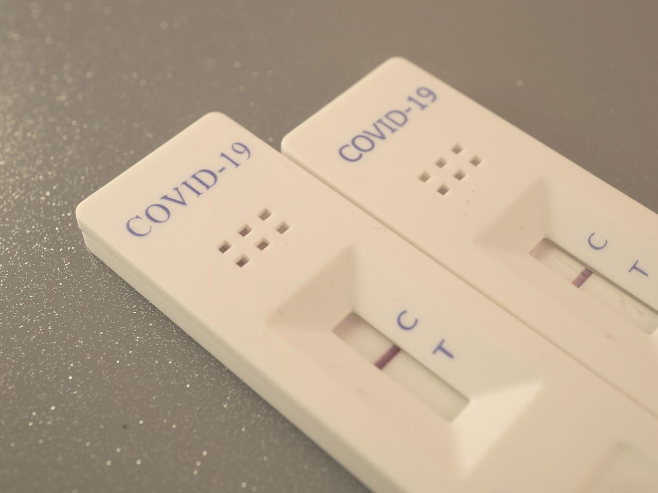 Bezpłatne badanie na przeciwciała koronawirusa w Szczecinku. Jest już komplet chętnych 