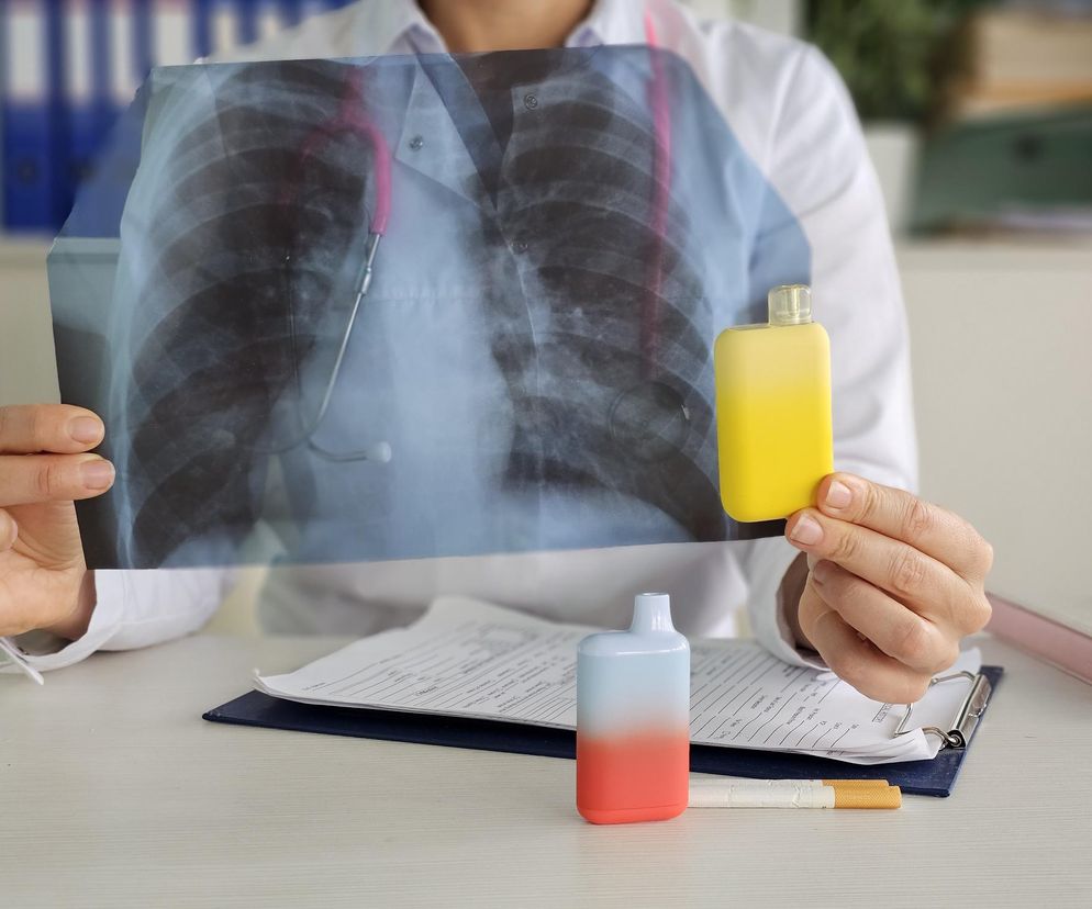 Obraz bez opisu - materiał na naszym portalu