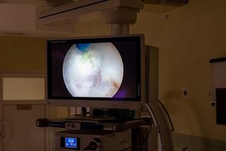 Mniej niż 10 urologów w Polsce potrafi to zrobić. Zabiegi pierwszy raz na Podkarpaciu [FOTO]