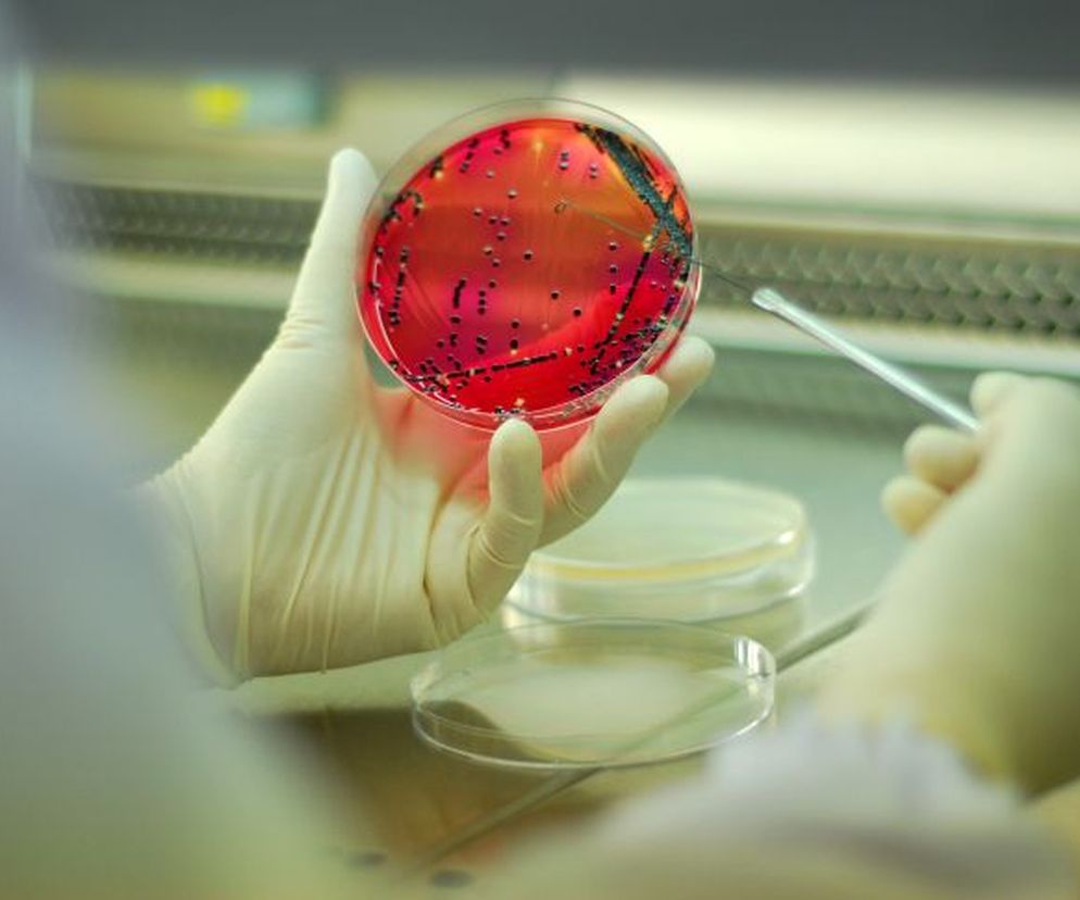 Zakażenie szpitalne: przyczyny zakażeń szpitalnych