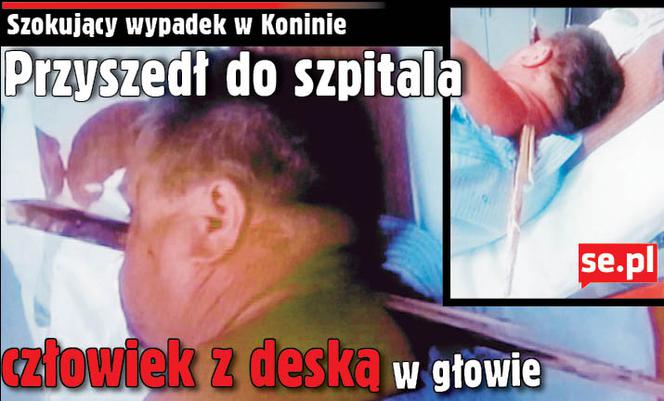 To prawdziwy CUD, że on żyje! Do szpitala o własnych siłach przyszedł człowiek z deską w głowie