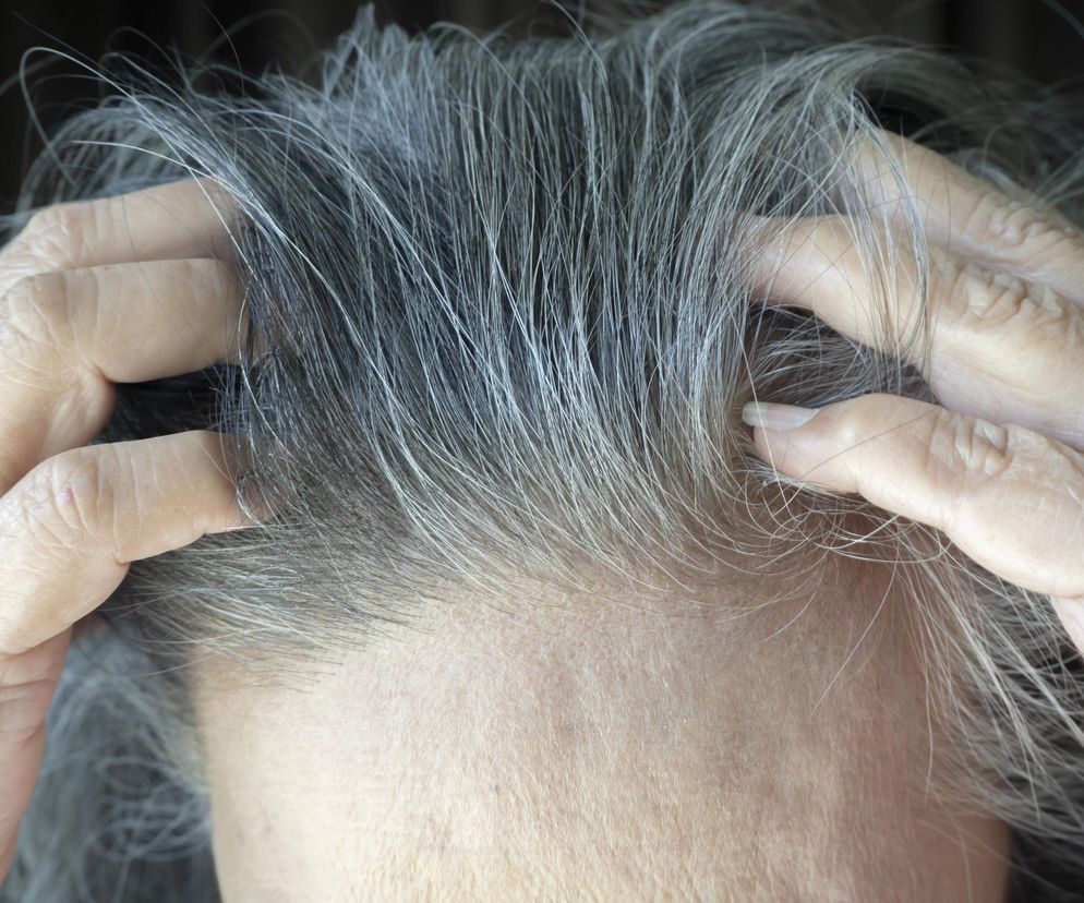 Skuteczny sposób na siwe włosy zrobisz za grosze. Stosuj, a zapomnisz o farbowaniu