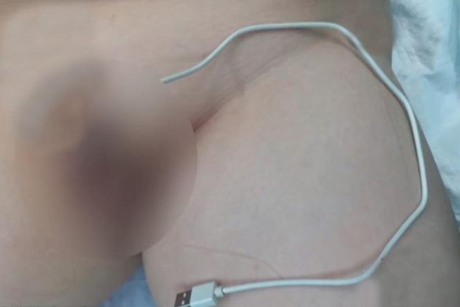 Wsadził sobie ładowarkę w penisa