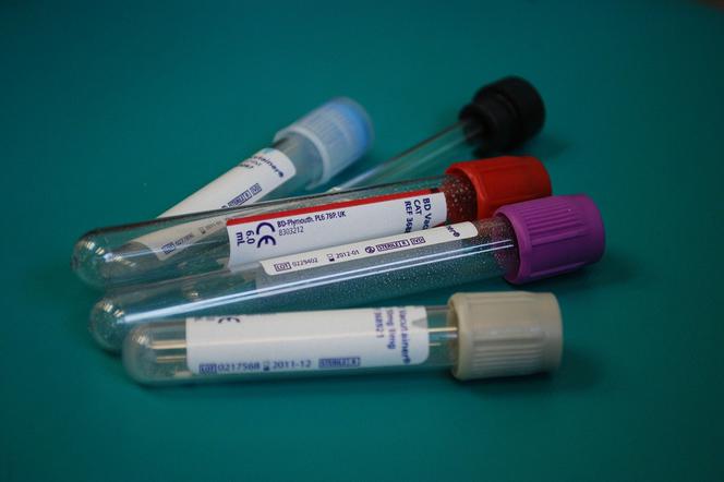 Od 4 marca w województwie Lubuskim wykonano nieco ponad 5 tys. testów na koronawirusa