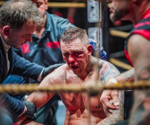 GROMDA 21: Zmasakrowana twarz Górala w walce