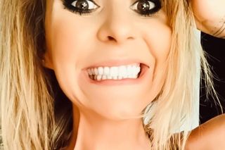 Katarzyna Skowrońska przeszła operację plastyczną