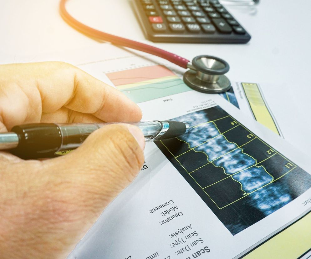 Dzięki densytometrii można wykryć osteoporozę we wczesnym etapie jej rozwoju.