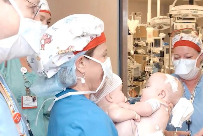 Urodziły się zrośnięte, matka oddała je tuż po porodzie. Dziś mają po 20 lat