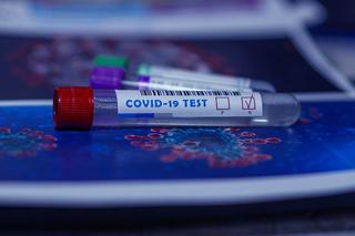 Darmowe testy na koronawirusa dla mieszkańców Świętokrzyskiego. Sprawdź, gdzie je dostać!
