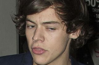 Harry Styles złamał nogę. Wypadek przyspieszy przerwę w karierze One Direction? 