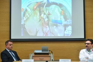 Konferencja prasowa. 9-letnia Lenka dostała nowe serce