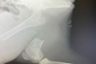  Łoś Iga złamała nogę musi przejść operację