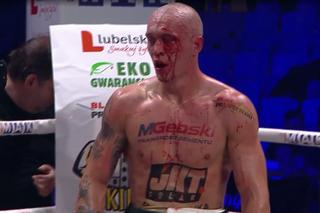 Masakryczne rozcięcie na twarzy polskiego pięściarza. Michał Cieślak zalał się krwią! Pojechał do szpitala