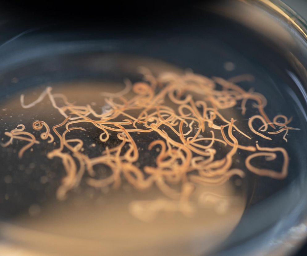 Ten pasożyt opanował polskie piaskownice i place zabaw. Zarażenie nicieniem może nawet zagrozić życiu