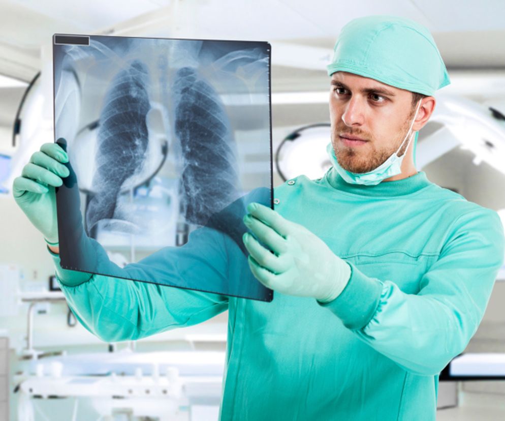 Usunięcie płuca. Kiedy trzeba usunąć płuco?