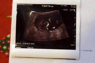 Mogli stracić dziecko przez błąd lekarki?