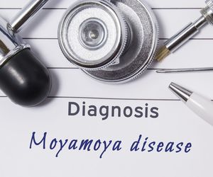 Choroba moyamoya: przyczyny, objawy, leczenie