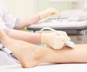 USG Dopplera (badanie dopplerowskie) wykrywa zmiany w żyłach i tętnicach