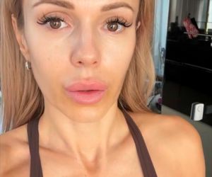 Doda pokazała bliznę po wycięciu czerniaka