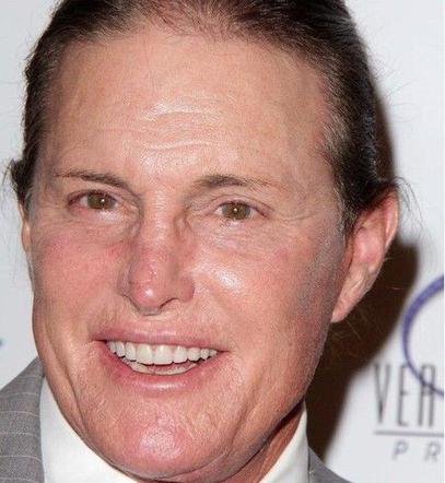 Bruce Jenner - operacja zmiany płci